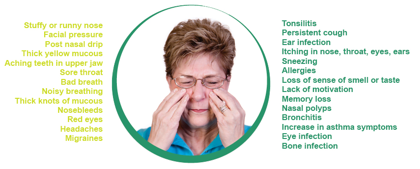 Sinus Infection (Sinusitis), Antibiotic Use